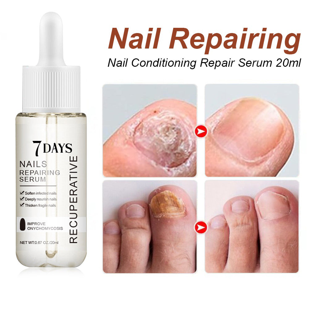 7 Days Nail Growth and Strengthening Serum