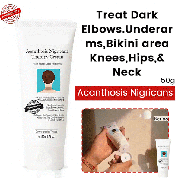 Acanthosis Nigricans Therapy Cream