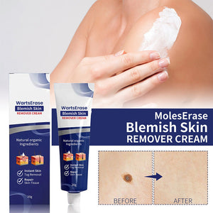 WartsErase Blemish Skin Remover Cream