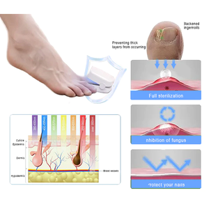 🔥Last Day Promotion 70% OFF🔥-Tiworld™ PROMAX Revolutionary High-Efficiency Light Therapy Device For Toenail Diseases